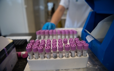 Imatge de l'arxiu del Taulí | Roger Benet